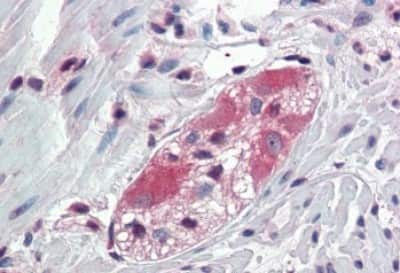 Immunohistochemistry-Paraffin: TXLNB Antibody [NBP3-14511] - Immunohistochemistry of formalin-fixed, paraffin-embedded human colon, ganglion cells, after heat-induced antigen retrieval.